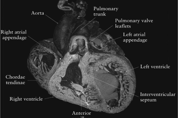 Novel imaging techniques to study postmortem human fetal anatomy: a systematic review on microfocus-CT and ultra-high-field MRI